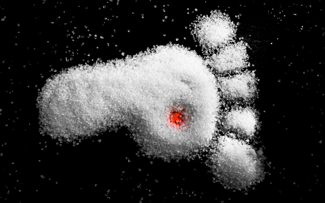 Diabetisches Fußsyndrom – wenn der Zucker die Füße in Gefahr bringt